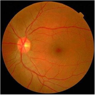 Veias na retina humana
